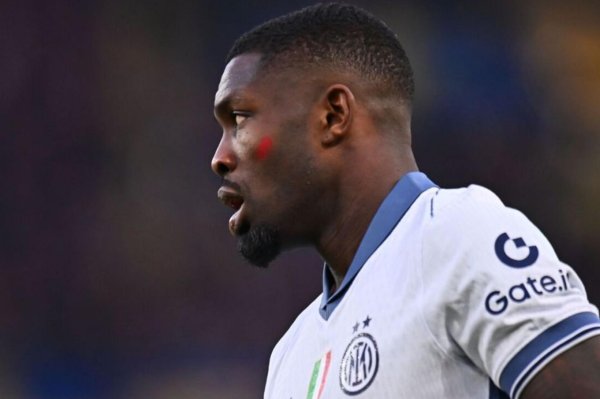 掌心策略 意甲球员在第十二轮比赛中涂上红色面彩，向针对女性的暴力说不